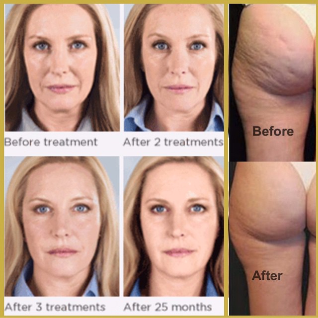 11371957_1627196784190428_604536571_n - Cópia