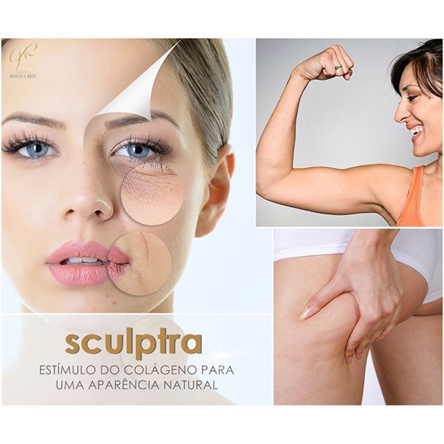 13266957_252374905124736_832496791_n